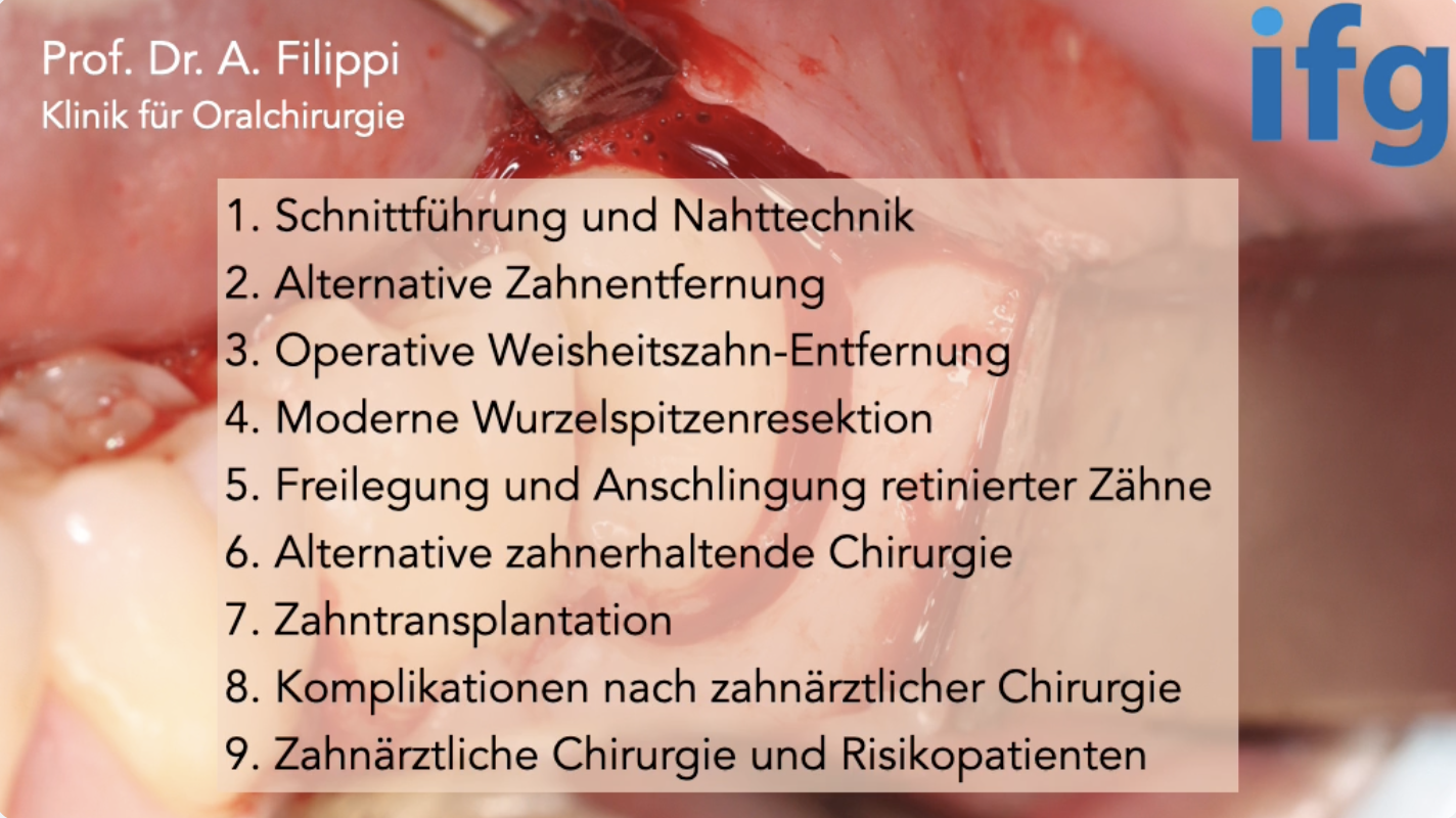 Prof. Dr. Andreas Filippi: Zahnärztliche Chirurgie 360° - ein kurzweiliges, cooles und aktuelles Update in 9 Modulen - Kurs: 9858