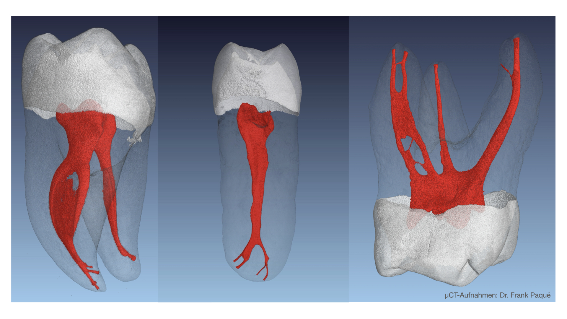 Endo-Kongress (3. Teil) - ENDO Aktuell | Fragen & Antworten - Kurs: 9838*