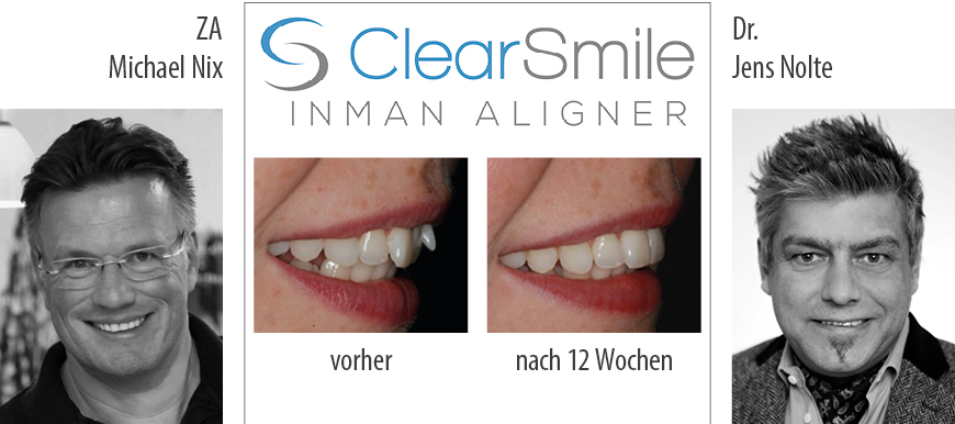 Ifg Fortbildung Za Michael Nix Dr Jens Nolte Inman Aligner And Clearsmile Aligner