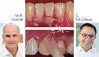 Prof. Dr. Stefan Fickl & Dr. Ralf Schlichting: Safety first! Parodontale & Endodontische Stabilität als Voraussetzung für eine erfolgreiche ästhetische Zahnheilkunde und Zahntechnik - Kurs: 5191