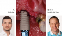 Die Implantologie Einsteiger-Woche: Von der Theorie bis zum fertig gesetzten Implantat - Kurs: 5226