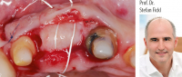 Prof. Dr. Stefan Fickl: Weichgewebsmanagement in der Parodontologie und Implantologie - Kurs: 5263