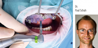 Dr. Paul Schuh: Digital und sofort – the modern art of implantology - Kurs: 5274